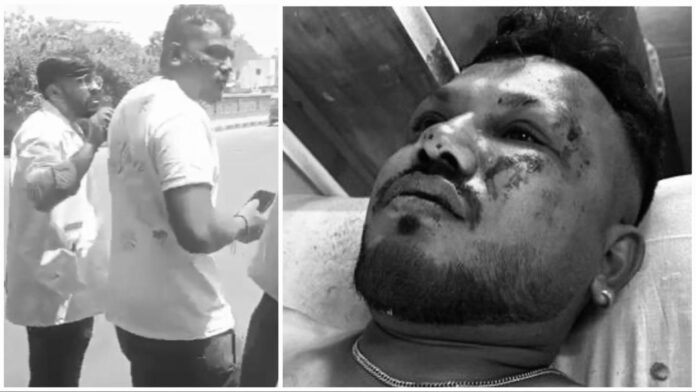 video:-man-on-seat-11a-miraculously-walks-out-after-deadly-air-india-crash