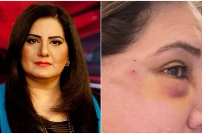 ‘i-have-50-more-pictures’:-pakistani-anchor-alleges-assault-by-ex-husband,-posts-photos
