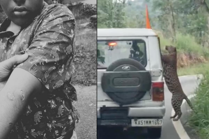 leopard-leaps-at-safari-vehicle-and-scratches-teen-at-bengaluru’s-bannerghatta-park-|-video