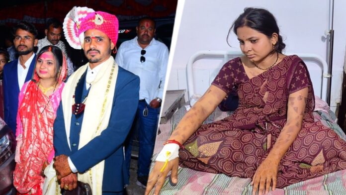 madhya-pradesh-man-ties-up-wife,-puts-hot-knife-in-her-mouth-over-dowry-demands